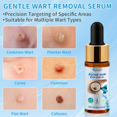 RushCure wart remover dropper demonstrates controlled dosage for precise use