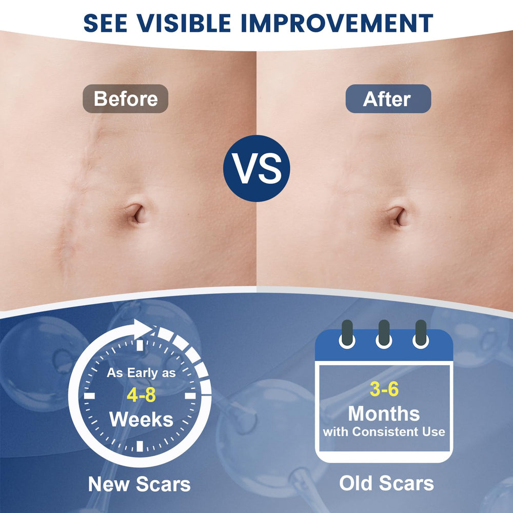 Targeted application area with Rvlaim scar care gel on skin