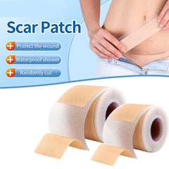 Safirst soft-breathable scar tape close-up shows thin, comfortable material.