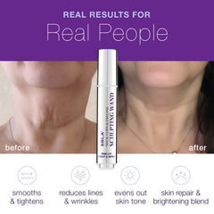 SBLA wand-dispense closeup shows precise serum delivery for targeted neck and jawline treatment.