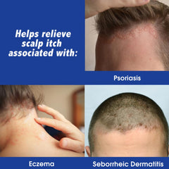 Scalpicin fragrance-free formula label emphasizes sensitive scalp use.