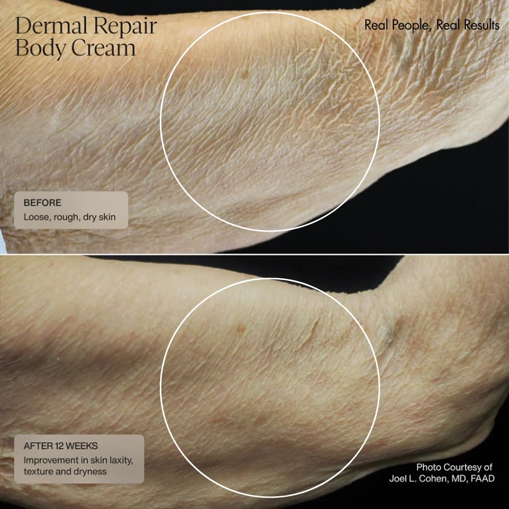 Sente Dermal Repair Body Cream with ceramide blend improves moisture retention.