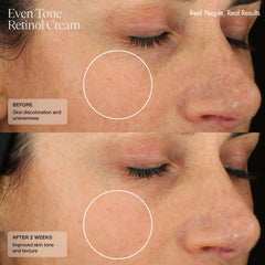Sente Even Tone Cream swirled on skin illustrating subtle tone refinement