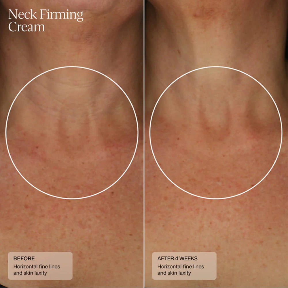 Sente HSA technology hydration concept supporting healthier-looking skin.