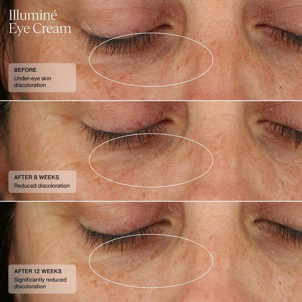 Senté Illumine Eye Cream delivers lasting hydration to the under-eye area
