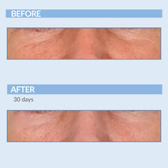 Serious Skincare A Force XR serum quick absorption after application