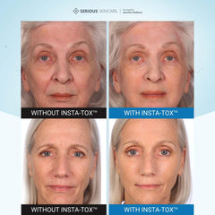 Serious Skincare INSTA-TOX application on the face demonstrates fast absorption