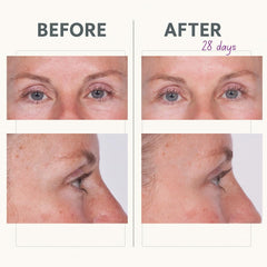 Reverse Lift Eye Cream firming around eyes and upper lid.