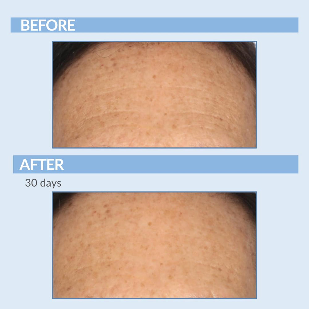 Serious Skincare Vitamin A Force XR serum application demonstrates easy daytime use.