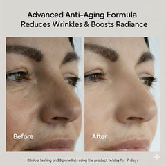 SetaLisse peptide serum bottle highlights premium, anti-wrinkle-inspired formula.