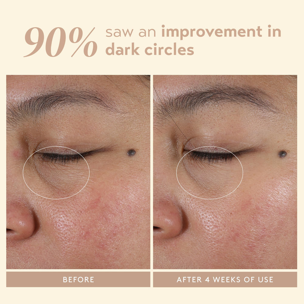 SHANI DARDEN Intensive Eye Renewal Cream creamy texture closeup suggesting rich hydration.