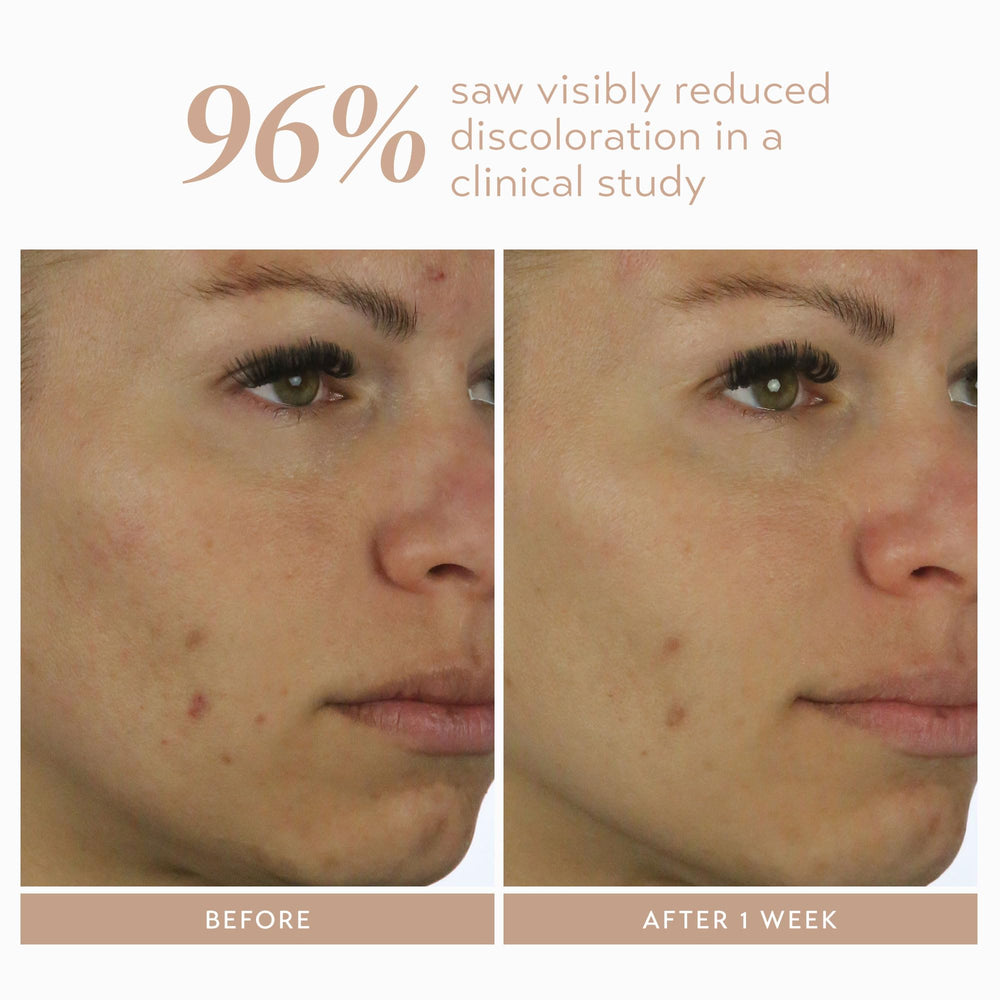 Shani Darden Rescue Serum delivers non-greasy finish for all skin types