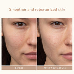 SHANI DARDEN Soothing Complex image suggests hydration-friendly formula.