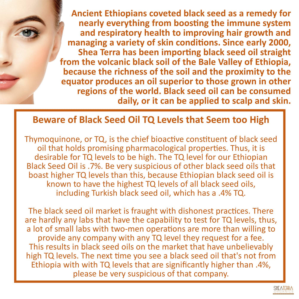 Amber bottle of Shea Terra Black Seed Oil in natural light, may aid skin hydration