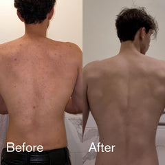 Shield Body Acne Wash branding front, suited for back and chest care.