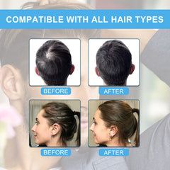 SHIFAKOU Hair Fibers for thinning temples instantly conceal patches and create a fuller look.