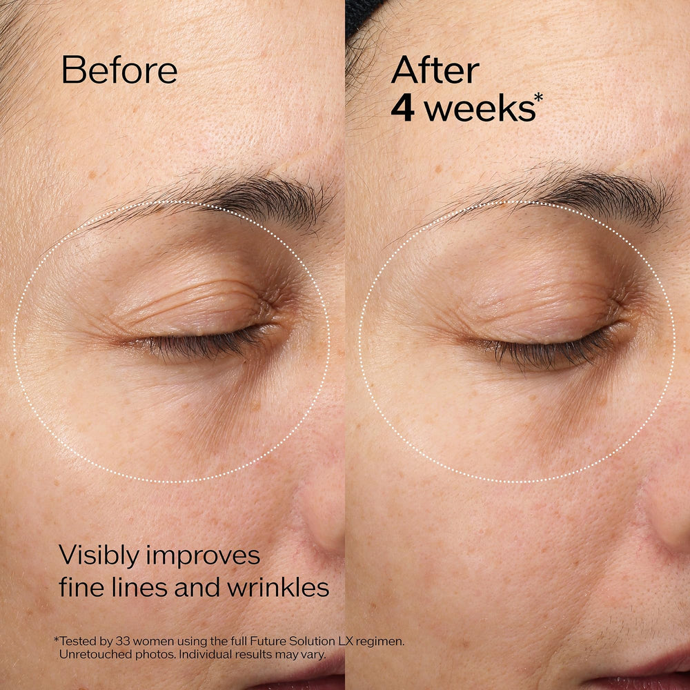 Shiseido Future Solution LX cream being gently applied around the eye area