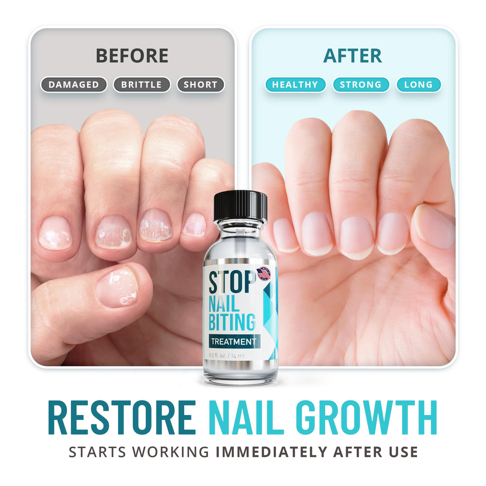 SISQUOC Stop Nail Biting nails with clear coat; easy daily wear.