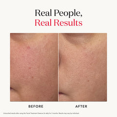Hands applying SK-II Facial Treatment Essence after cleansing for quick absorption.