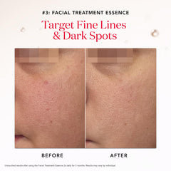 SK-II routine step image illustrating essence-then-mask usage for improved skin texture.