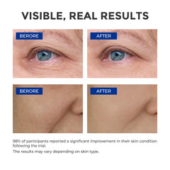 SKINERSE serum-absorbs-fast texture highlights lightweight, non-greasy finish.