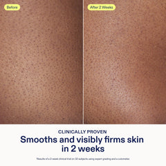 Application area shows even coverage and quick hydration from Skinfix cream.