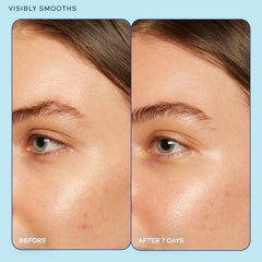 Skinfix Barrier+ Gel Cream Mini ingredients graphic showing barrier-strengthening components.