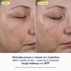 Close-up of hydrated skin after cleansing with Skinfix Ceramide + Ectoin