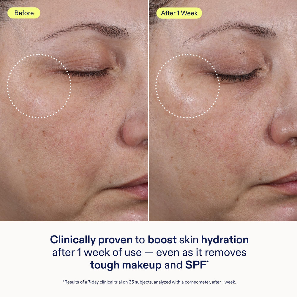 Rinsing Skinfix cleanser off, leaving skin feeling refreshed and clean.