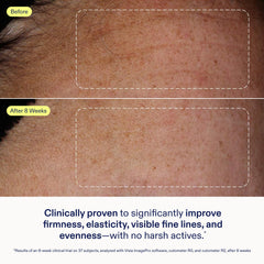 Skinfix Exo Ectoin Intensive Repair Baume fragrance-free packaging emphasizes clean formula.