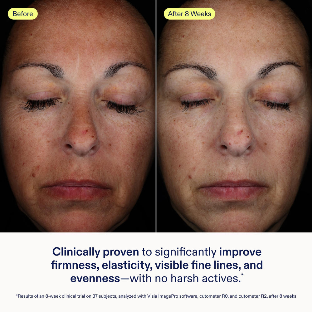 Skinfix Exo Ectoin Intensive Repair Baume silky texture shown for quick absorption on skin.