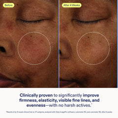 Skinfix Exo Ectoin Intensive Repair Baume vegan cruelty-free identity in product presentation.