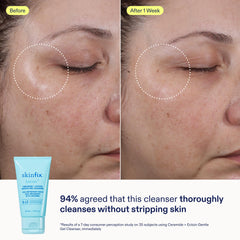 Skinfix Mini Ceramide Ectoin Gel Cleanser emphasizes pore-friendly cleansing
