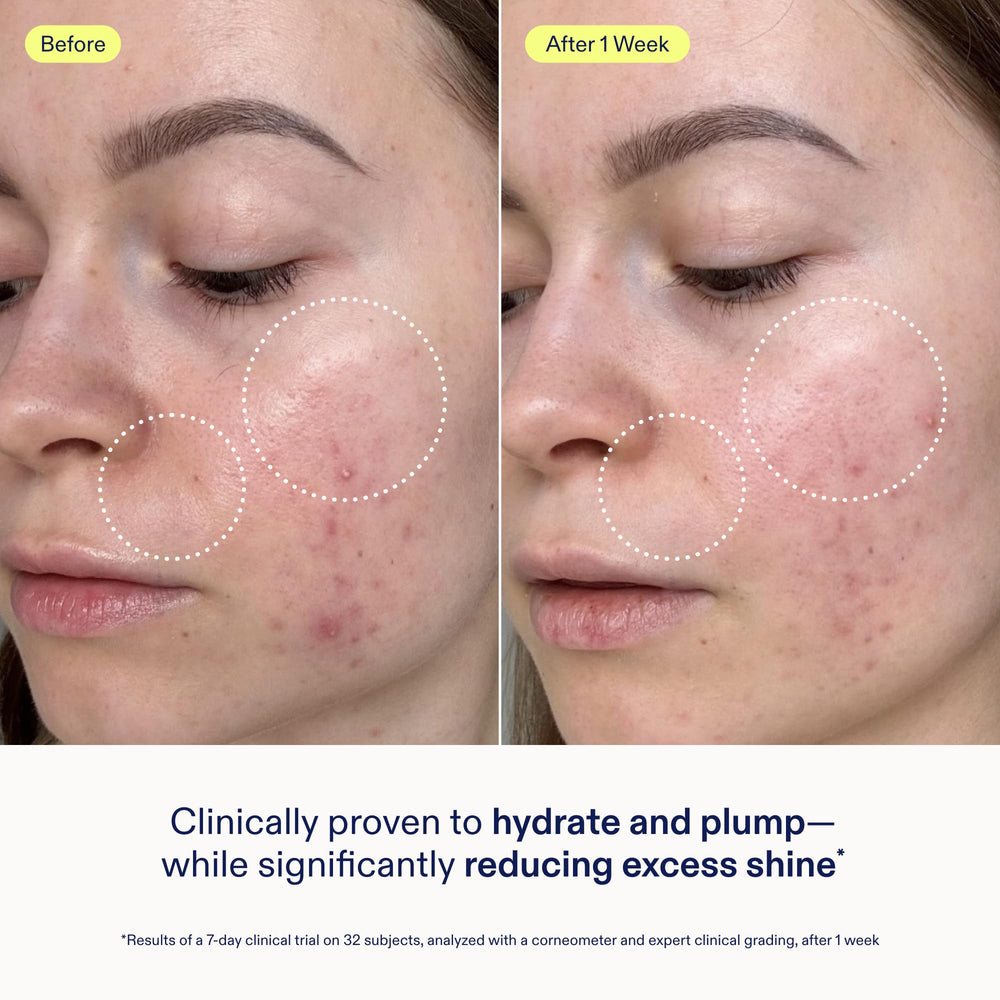 Skinfix Skin Barrier Gel Cream ingredients featuring 3% lipid complex for barrier support