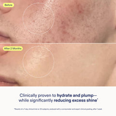 Skinfix Skin Barrier Gel Cream texture closeup of silky, fast-absorbing formula
