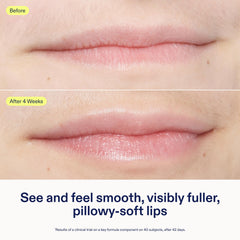 Skinfix Triple Lipid Lip Treatment lips close-up suggests pillow-soft fullness
