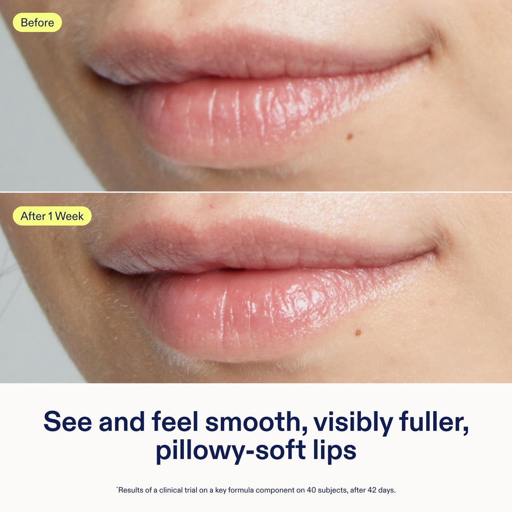 Skinfix Triple Lipid Lip Treatment packaging highlighting fragrance-free, vegan cruelty-free formula