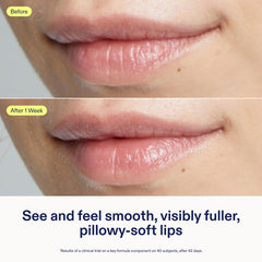 Skinfix Triple Lipid Lip Treatment packaging highlighting fragrance-free, vegan cruelty-free formula