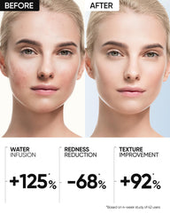SKINTIFIC Truffle Biome ceramide gel layer detail for moisture retention