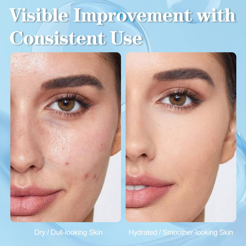 SKSOYT Hyaluronic acid serum texture highlighting hydration boost.