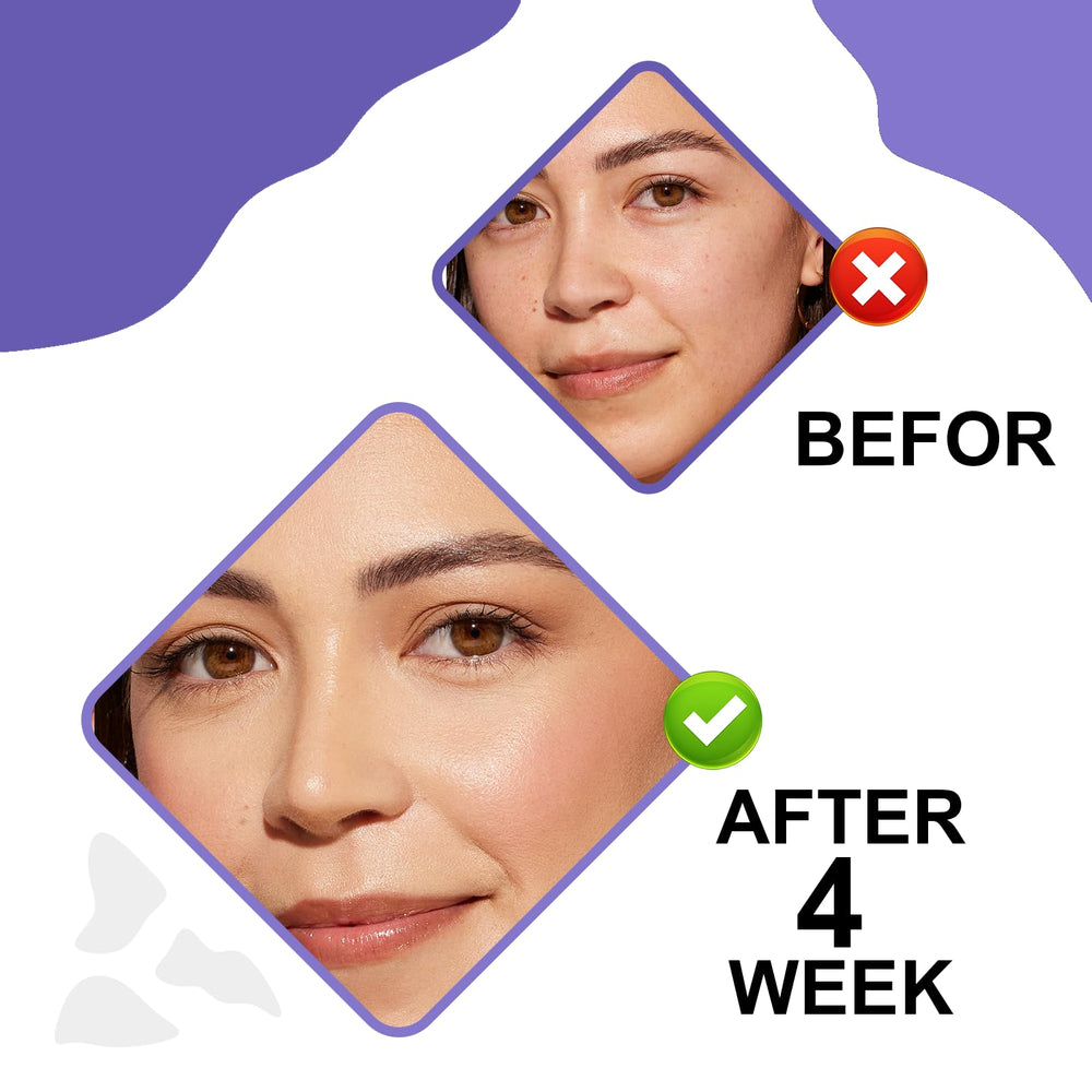 SKSOYT packaging box front hints at premium anti-aging care.