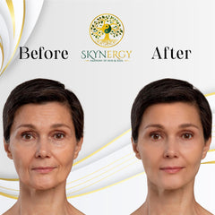 Skynergy Skin Sovereign jelly mask for all skin types, including sensitive.
