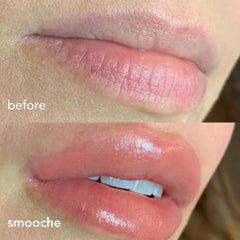 Smooche lip plumper glossy lips image highlights rich shine and enhanced volume.