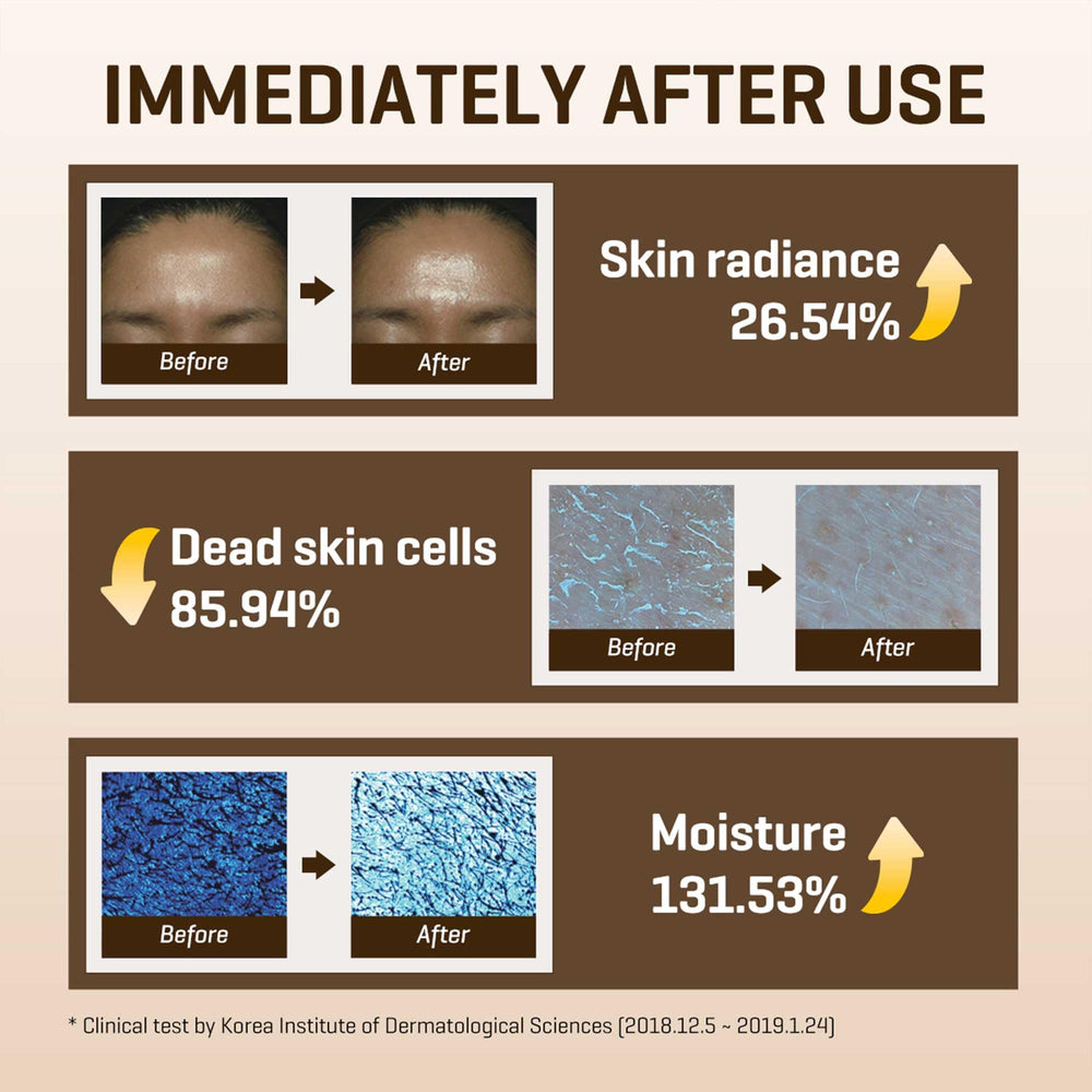 SOME BY MI Galactomyces Vitamin C Glow Toner packaging box communicates clean skincare