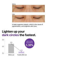 SOME BY MI eye cream under-eye application demonstrating gentle use