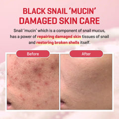 Snail mucin and Truecica ingredients close-up in SOME BY MI serum