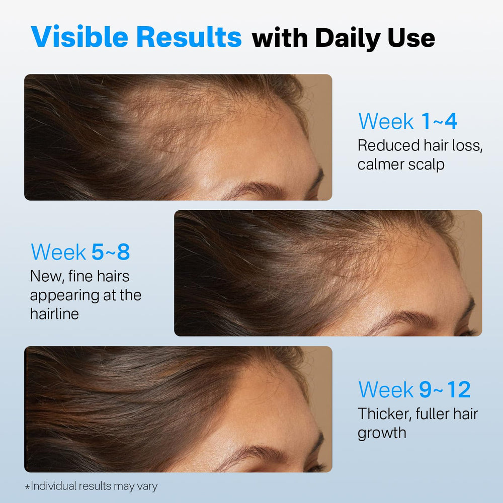 SORNBEO saw palmetto action promoting scalp balance