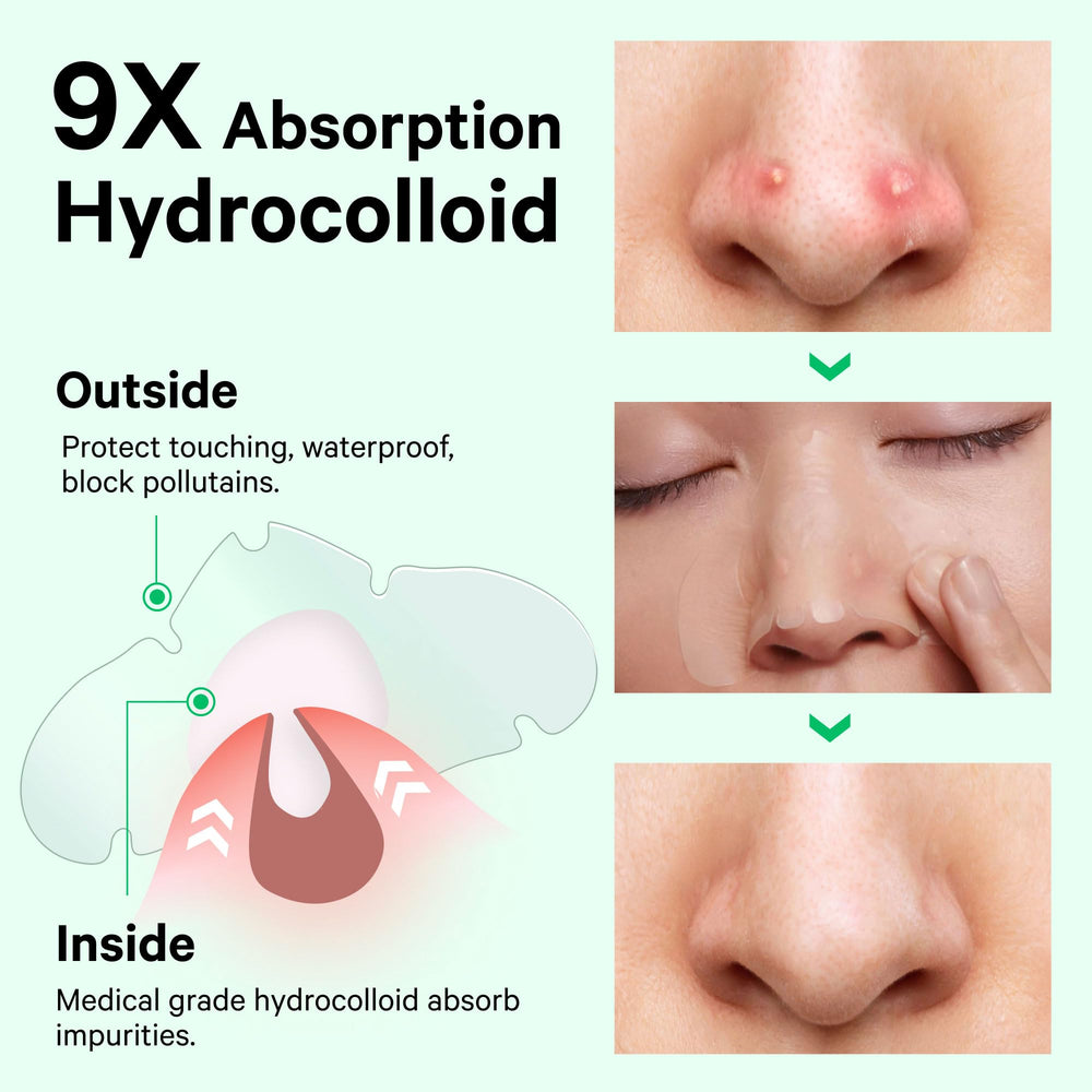 Sosky Nose Patch 4-hour action demonstrates quick pore clarity
