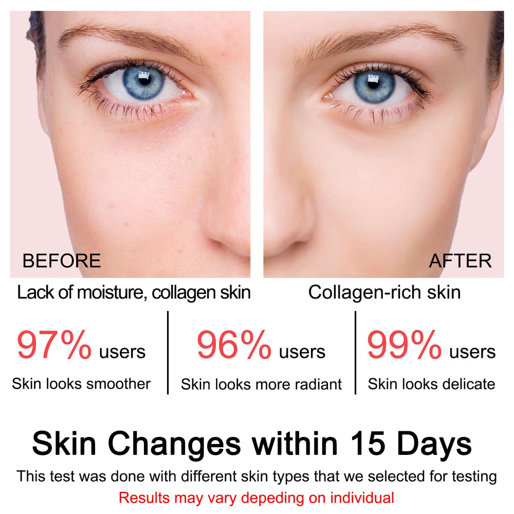 SOYUB Collagen Jelly Cream night use image suggests overnight nourishment
