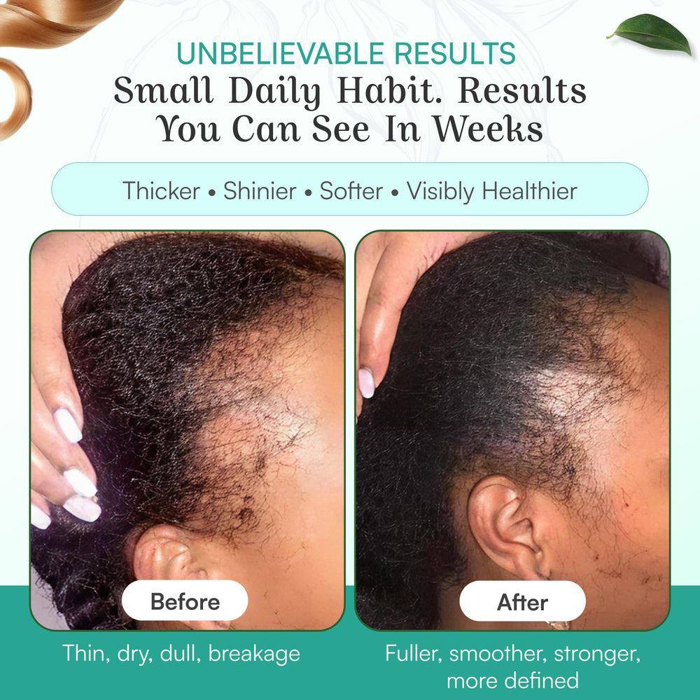 Spoild Batana Oil use – massage into scalp, wait 20 minutes, rinse.